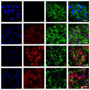 Overcoming Chemotherapy Resistance Using a Cow’s Milk Protein