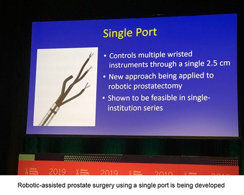 Robotic-assisted prostate surgery using a single port is being developed.