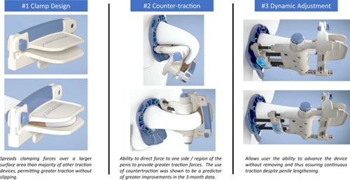  Penile Traction Devices for Men Traction Device,Male